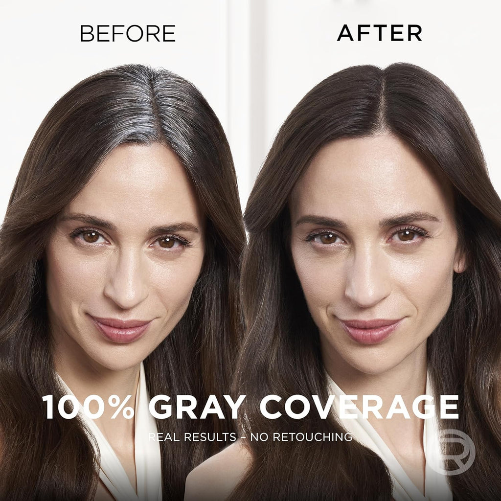 Magic Root Cover up Gray Concealer Spray Dark Blonde 2 Oz.(Packaging May Vary)
